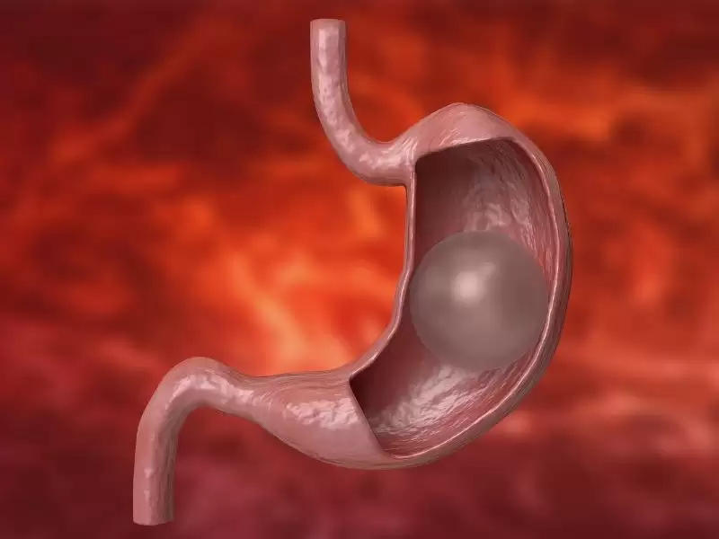 mide-balonu-takildiktan-sonra