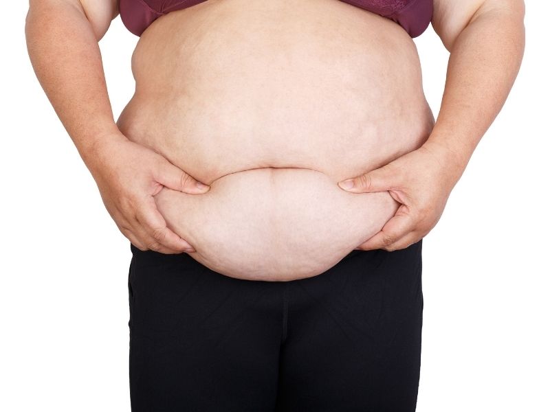 zayiflama-ameliyati-sonrasi