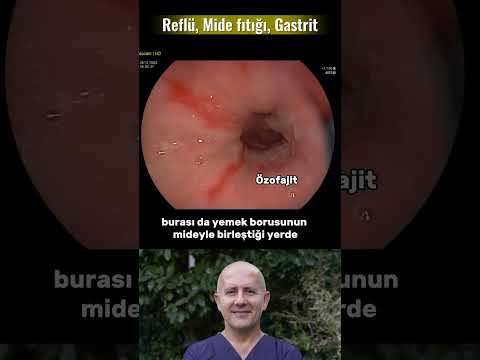 video,paylaşım,kameralı telefon,videofon,ücretsiz,yükleme